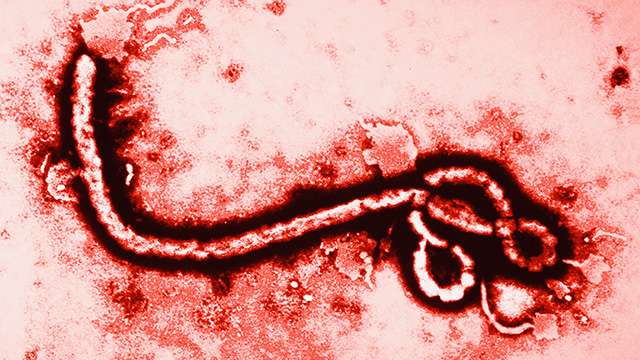 ebola-virus-magnified